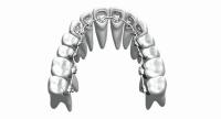 As cintas ortodônticas fixas dos dispositivos do costume endireitam os dentes Bioceramic de aço inoxidável