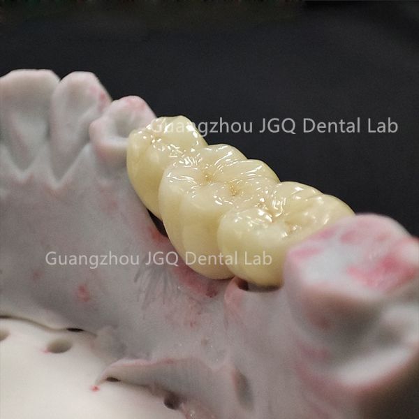 Monolithic Zirconia Crowns Dentures CAD/CAM 1200 MPa Flexural Strength for Dental Bridges