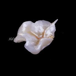 Digital Empress Onlay And Inlay Customized By Dental Prosthesis Laboratory