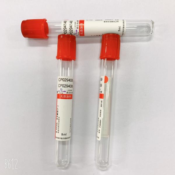 Do vácuo do sangue da coleção do tubo anticoagulação lisa consumível não