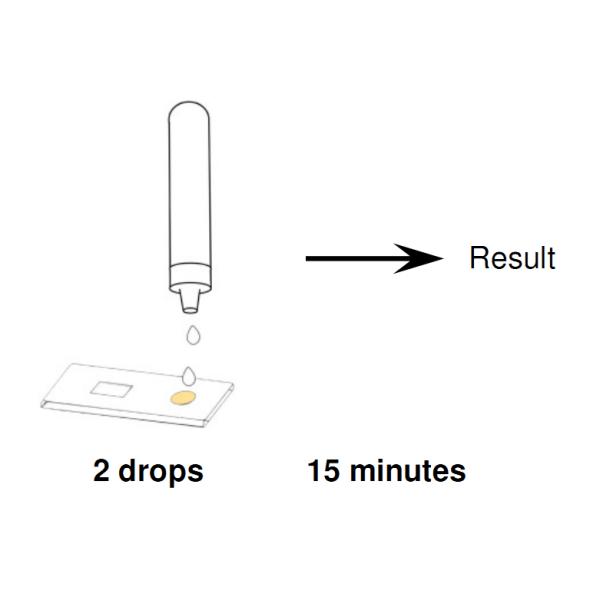 Аксессуары наборов пробирки домашние испытывая полные, точность набора 96% теста дома чламидии