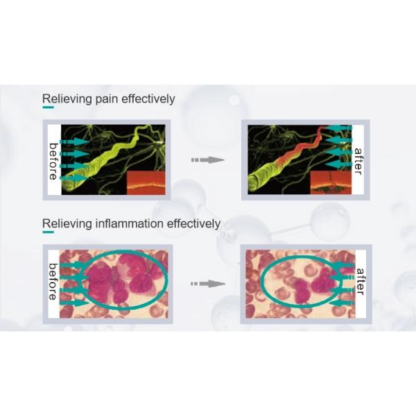 650nm 808nm Infrared Red Laser Therapy Device For Pain Relief