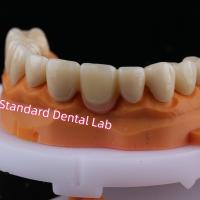 La couronne de pont en zirconium couche avec porcelaine rose