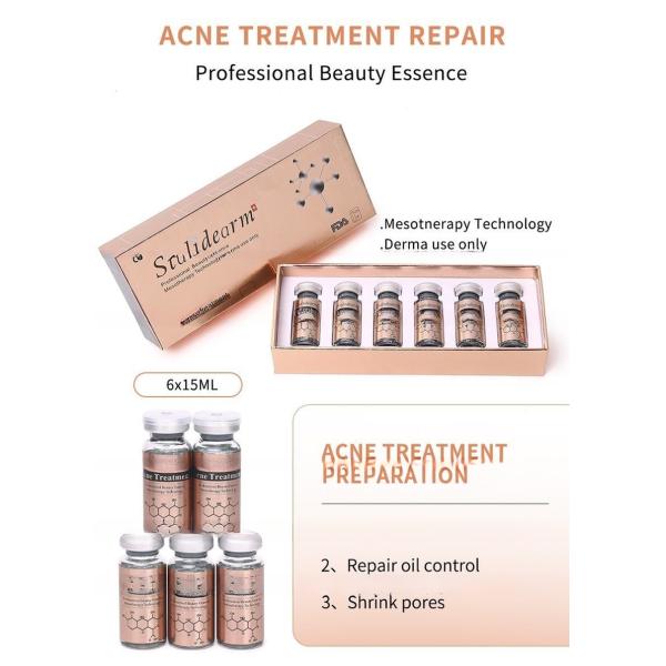 Stalidearm Acne Treatment Face Meso Serum Anti Acne Pimple Scar Remover Moisturizing Whitening Skin Care Facial Essence
