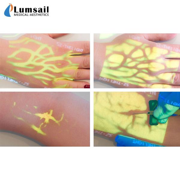 Doctor Nurse Easy Use Vein Finder Viewer Transilluminator For Phlebotomy Hospital Clinic