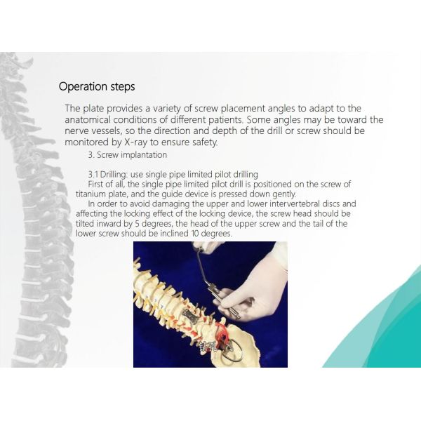 Spine Anterior Cervical Plate Titanium Cervical Plate Implant Orthopedic Surgery CE Certification