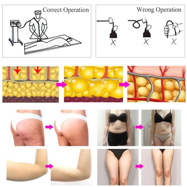 Lymphatic Drainage G5 Cellulite Machine Weight Loss Body Massager Fat Burning