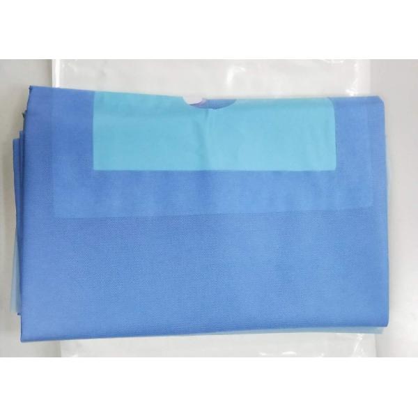 Больница верхней оконечности руки устранимая покрывает не сплетенное слоение SPP