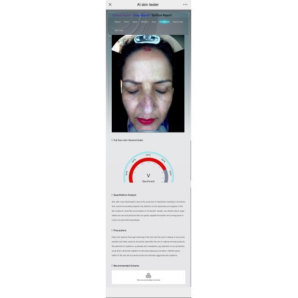 Skin Analyzer Reports Bitmoji Max Plus Facial Scanner Skin Scope Analysis Device