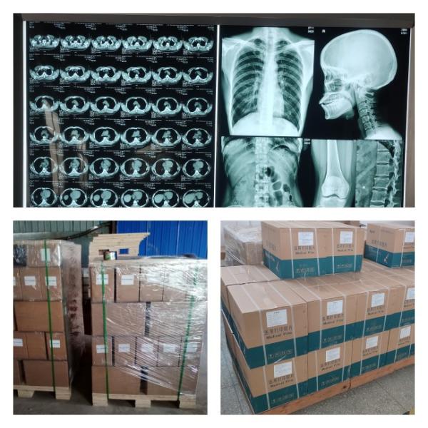 Película de radiografía médica del CT dr MRI del CR