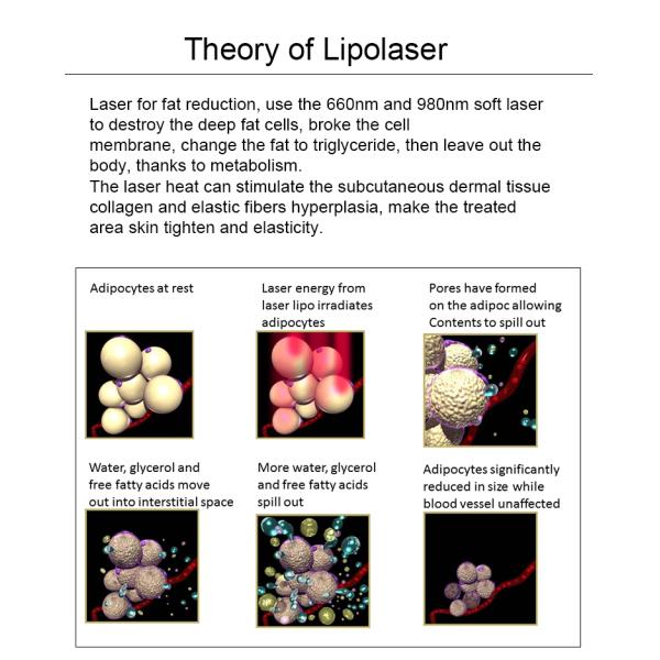 Терапия лазера Липо лазера 4 диодов длины волны подвергает механической обработке 12 пусковых площадок уменьшая машину красоты