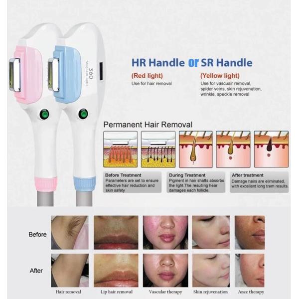High Efficiency SHR IPL Hair Removal Machine With 360 Magneto Optical System