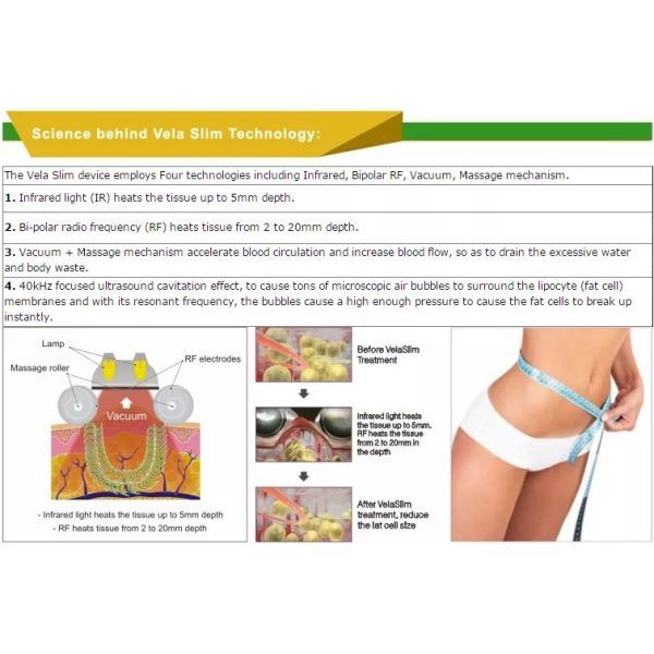 40K Cavitation Vela Shaping Vacuum RF Machine Weight Loss Cellulite Reduction