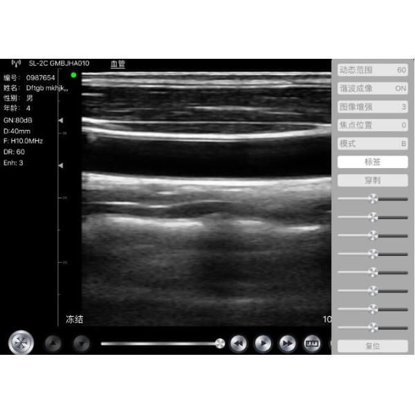 Зонда ультразвука зонда ультразвука кармана элементы 2.4G Wifi веса 235g 128 ультразвука беспроводного Handheld мини только