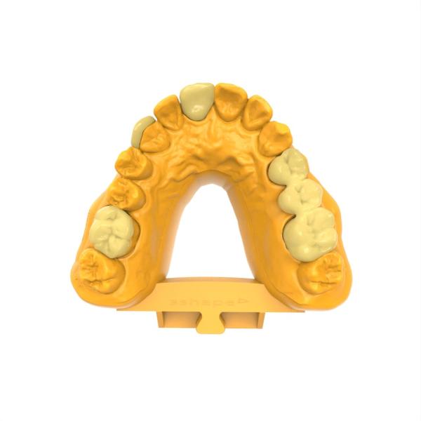 Résine de pont à couronne permanente inodore