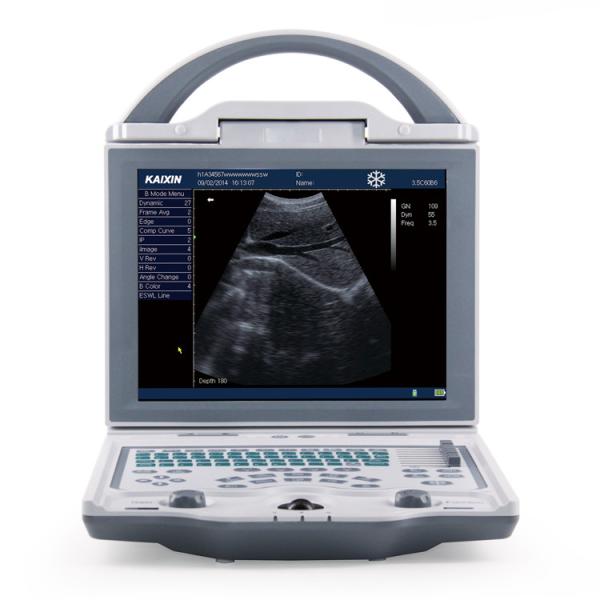 Diagnostic Medical Ultrasound Machine KX5600 Ultrasound Machine Full Digital B Mode