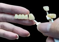 Resistente a manchas Todas as pontes de porcelana confortável adequado para restauração dentária