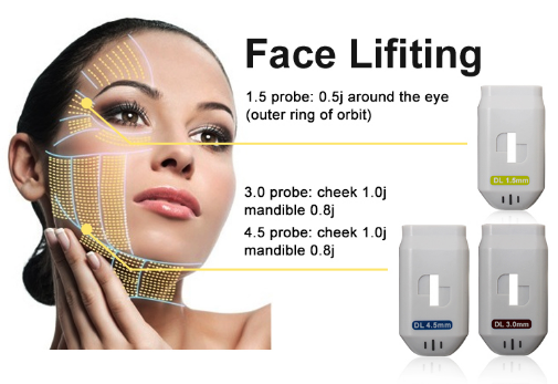 Ультразвуковая кожа машины красоты Хифу укрепляя оборудование Хифу 5Д 7Д