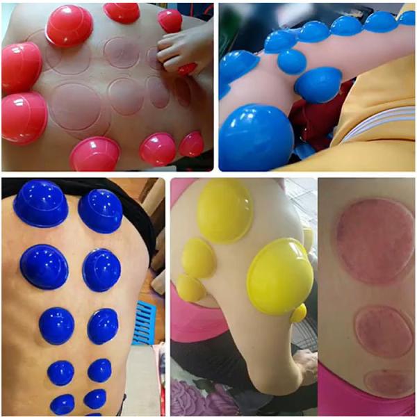 Facial Cupping Therapy Set Silicone Cupping for Chinese Medicine Apparatus and Face