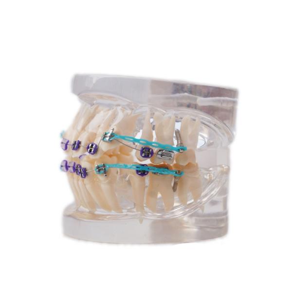 Multi Color Human Teeth Model For Study Dental Orthodontic Teeth Model With Bracket