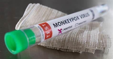 Jogo do PCR do tempo real do reagente da detecção do vírus de Monkeypox