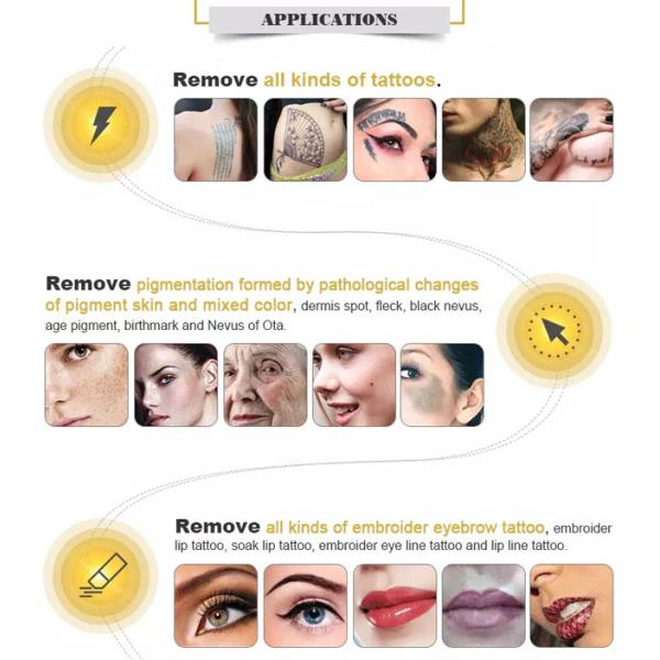 Professional ND YAG Laser Tattoo Removal Machine For Eyebrow Tattoo Removal