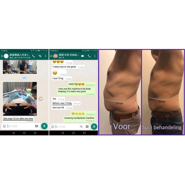 the most effective cryo slimming machine  paypal accepted Hot sale salon and clinic use best quality