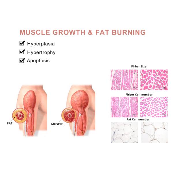 3 en 1 máquina elegante de la onda de choque de la terapia física el ccsme del alivio del dolor de Tecar para el tratamiento del ED