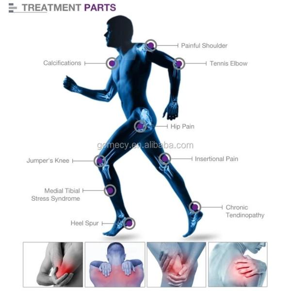 Черное белое Emshock 2 в 1 настольной версии машины терапией ударной волны для клиники