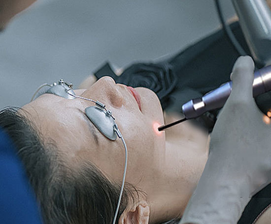 10600nm CO2 Fractional Laser Skin Resurfacing Gynecology Surgical Treatment System