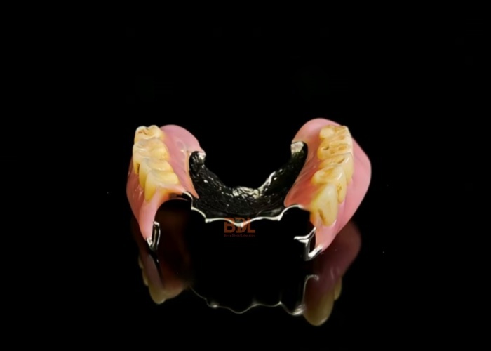 Biocompatible Metal Framework Partial Dentures manufactured to meet stringent dental industry standards and patient safety