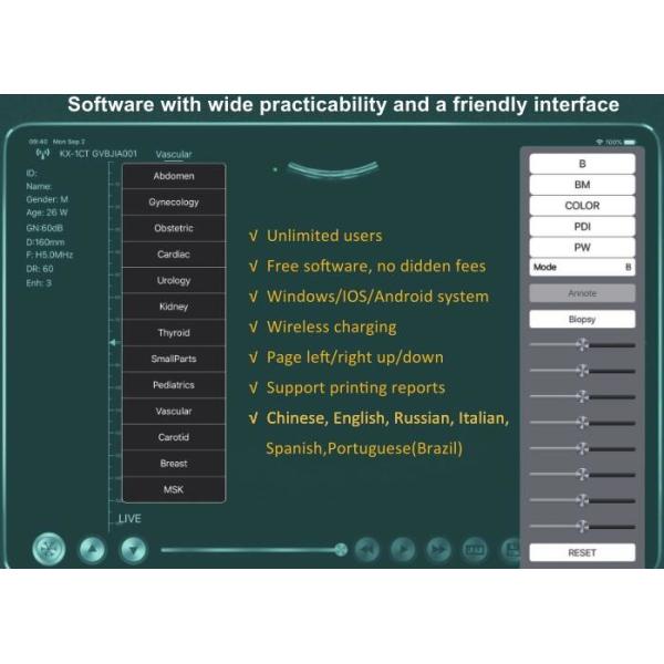 Cuerpo linear cardiaco 3 del PDA de Digitaces del ultrasonido del escáner de la conexión inalámbrica de Wifi EN 1 radio que carga 6 idiomas