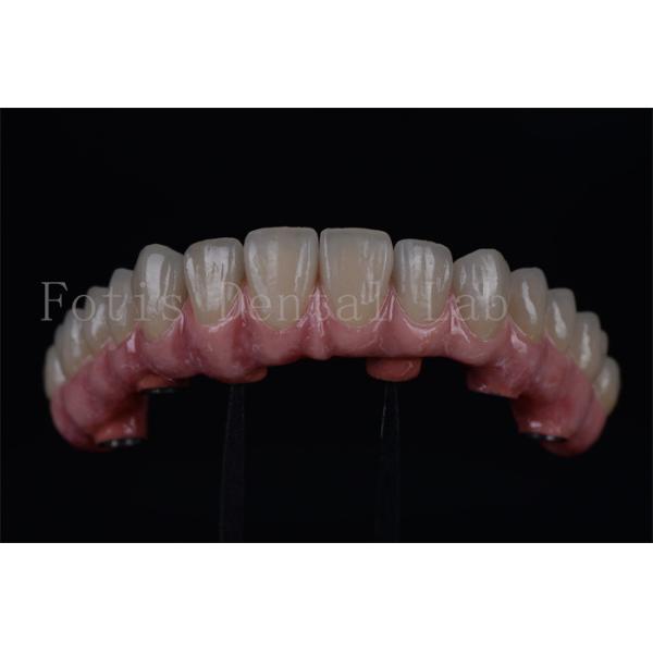 Titânio / Zircônio de longa duração Todos em 4 Todos em 6 Rápida recuperação 1-2