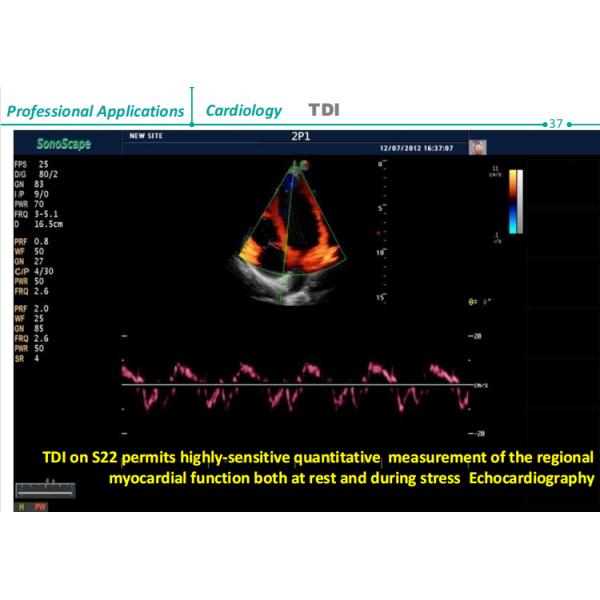 Stock SonoScape S22 ultra 5G Ultrasound Machine, Wireless Ultrasound for Veterinary Ultrasound Diagnosis