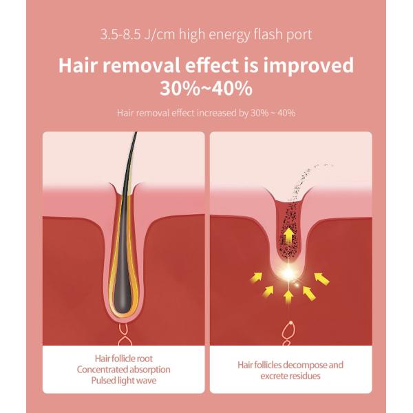 Машины удаления Epilator волос лазера Ipl льда прибор перевозчика волос крутой постоянный безболезненный