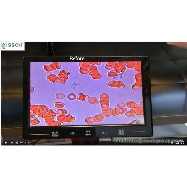 3 In 1 Low Light Laser Therapy For Diabetes OEM / ODM