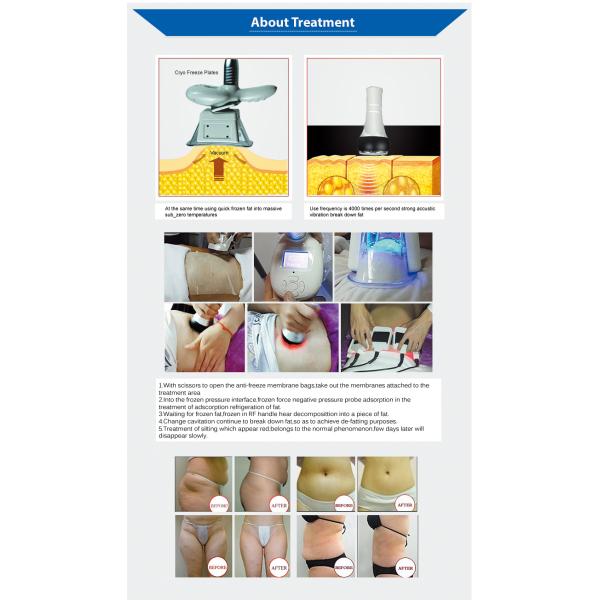 40K Cavitation Cryo Fat Freezing Machine For Body Shaping Slimming 650nm