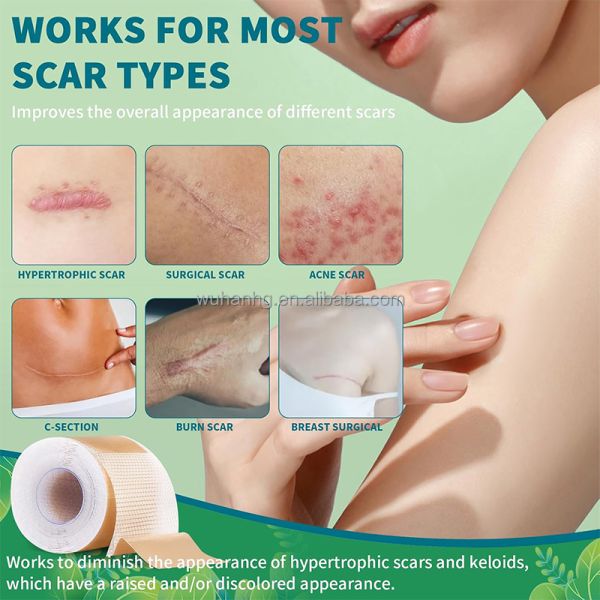 10cm width Self Adhesive Silicone Scar Removal Patch Hypoallergenic Scar Removal Tape