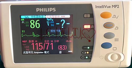 Philip MP2 a employé le moniteur patient