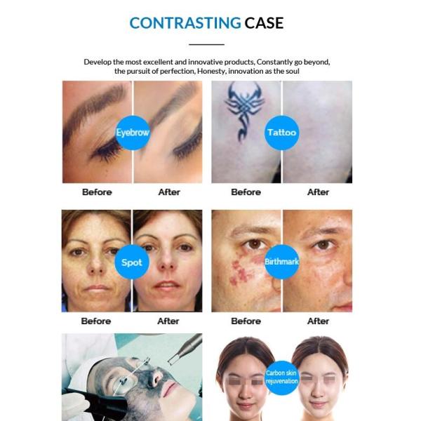 КЭ РоХС доказал переключенный к лазер яг нд на машина 755 меласма 1064 532 1320нм