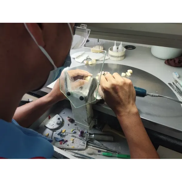 Customized Dental Crown and Bridge Porcelain Fused to Zirconia with CE FDA Certification and 3D Laser Printing