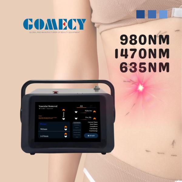 Highly Effective 1470nm Fiber Facial Lifting with 980nm and 635nm Wavelengths