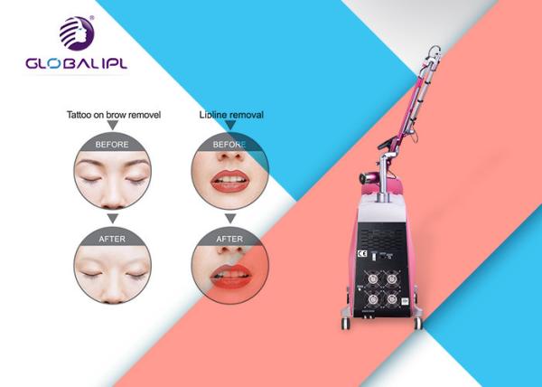1-10HZ Picosecond Laser Machine / 2000W Tattoo Removal Equipment With SBS System