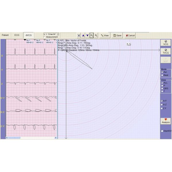 Canal 3, manual/auto/análisis/sistema de vigilancia del almacenamiento ECG con la función avanzada [del helada]