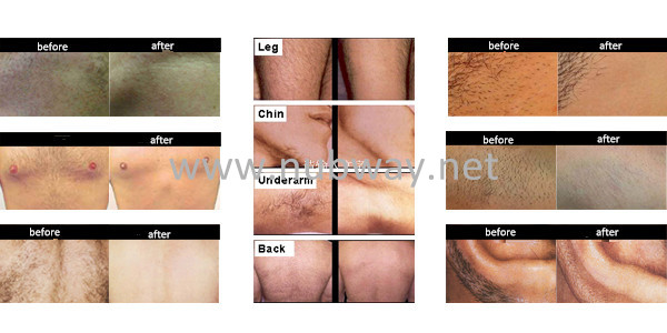 Portable IPL Skin Rejuvenation Hair Removal Machine / Device 110 - 240V 2019 hottest in big sale