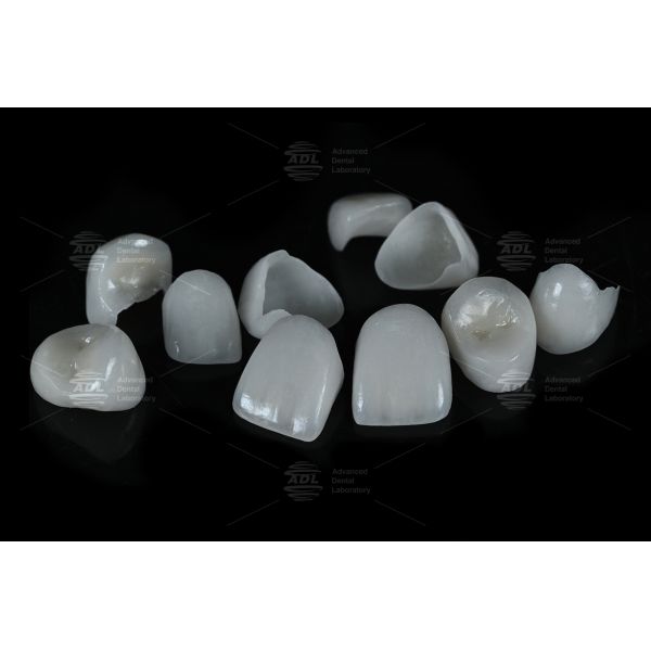 0.3mm-0.7mm Feldspathic EMAX Ceramic Veneers Natural Aesthetic Emax Dental Veneers