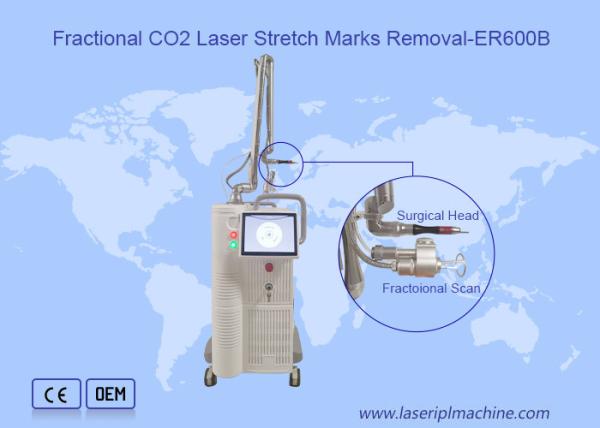 Máquina fracionária do laser do CO2 da exploração 10600nm 10x10mm da remoção da cicatriz