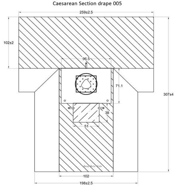 Absorbent Reinforced 40g - 60g SP / SMS / SMMS / SMMMS C-Section Surgical Drape For Caesarean Section With Collection