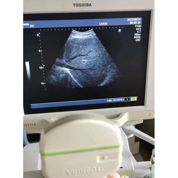 Зонд ультразвука датчика массива Тошиба PVM-375AT выпуклый на зрение 6000 силы серии SSA-370A Тошиба Nemio