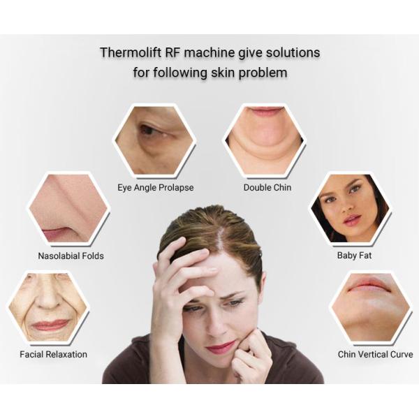 220V 110V RF Beauty Machine 40.68Mhz Radio Frequency Skin Tightening Machine